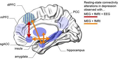 Alterations of Intrinsic Brain Connectivity Patterns in Depression and Bipolar Disorders: A Critical Assessment of Magnetoencephalography-Based Evidence